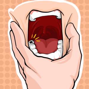 Can't Handle The Tooth